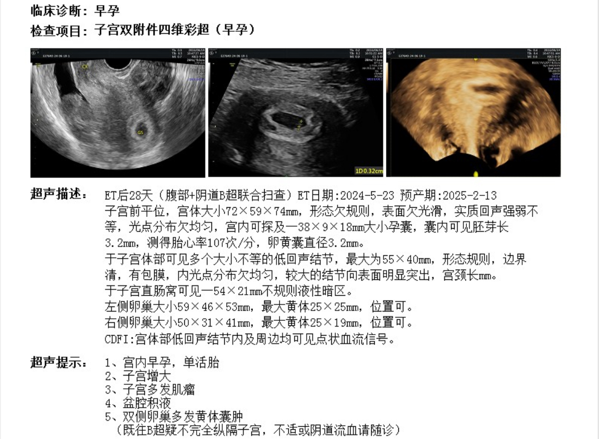 两次b超间隔一周分别是第21天和28天盆腔积