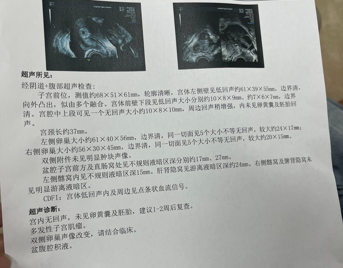 两次b超间隔一周分别是第21天和28天盆腔积