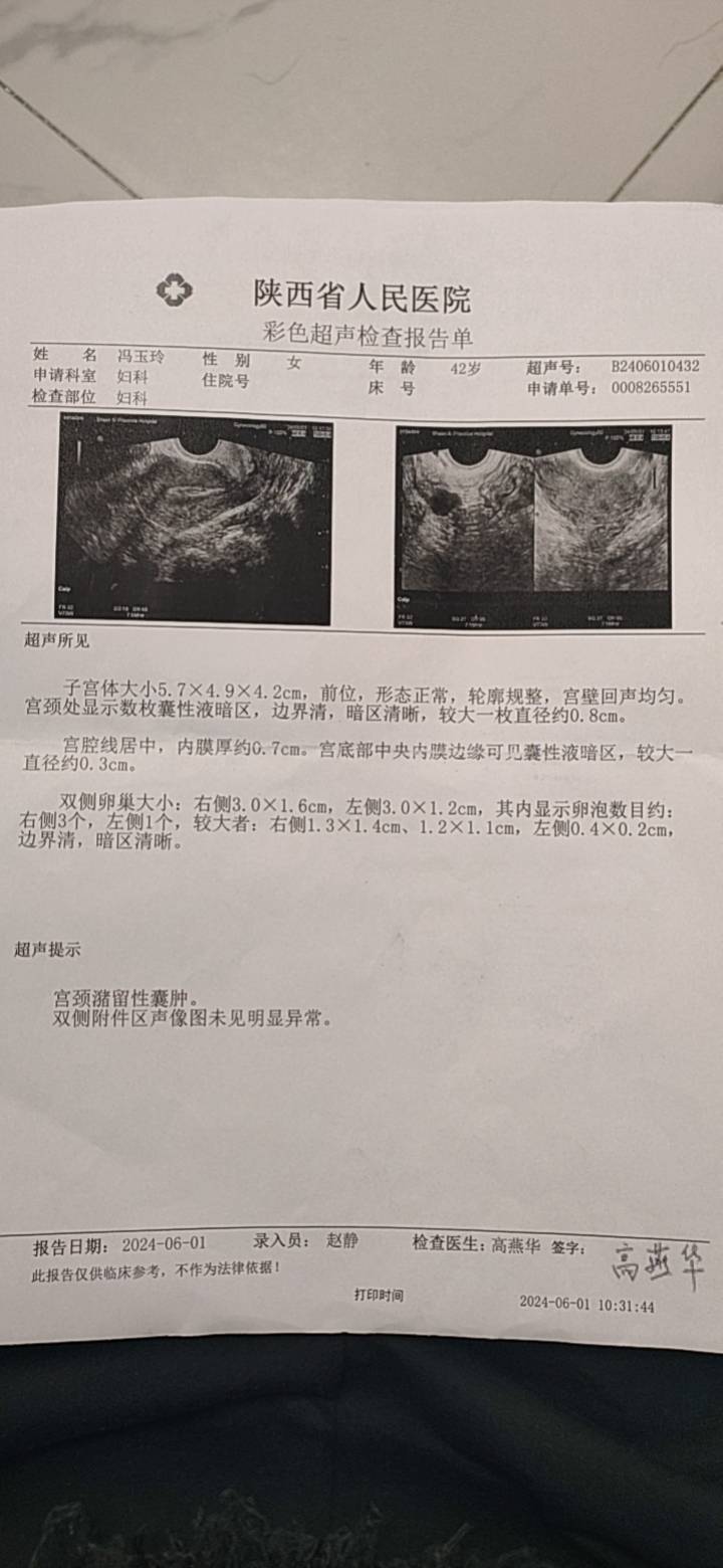 3月21号稽留流产后人工周期5月21号来的第