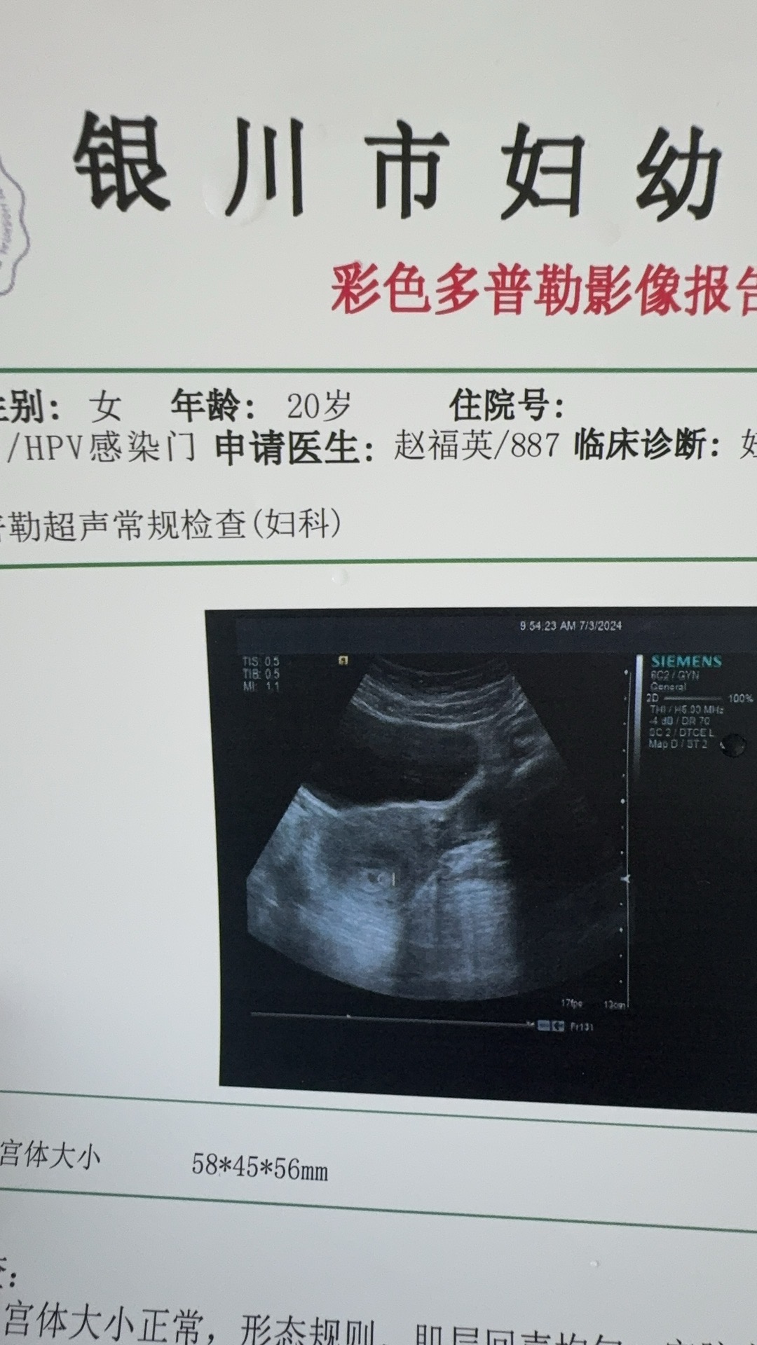 这个多少天了左下小腹隐隐疼痛坠疼