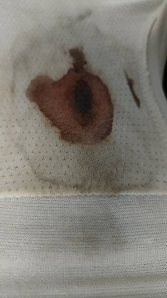 医生您好我这个月第四天就干净了然后是干净之后