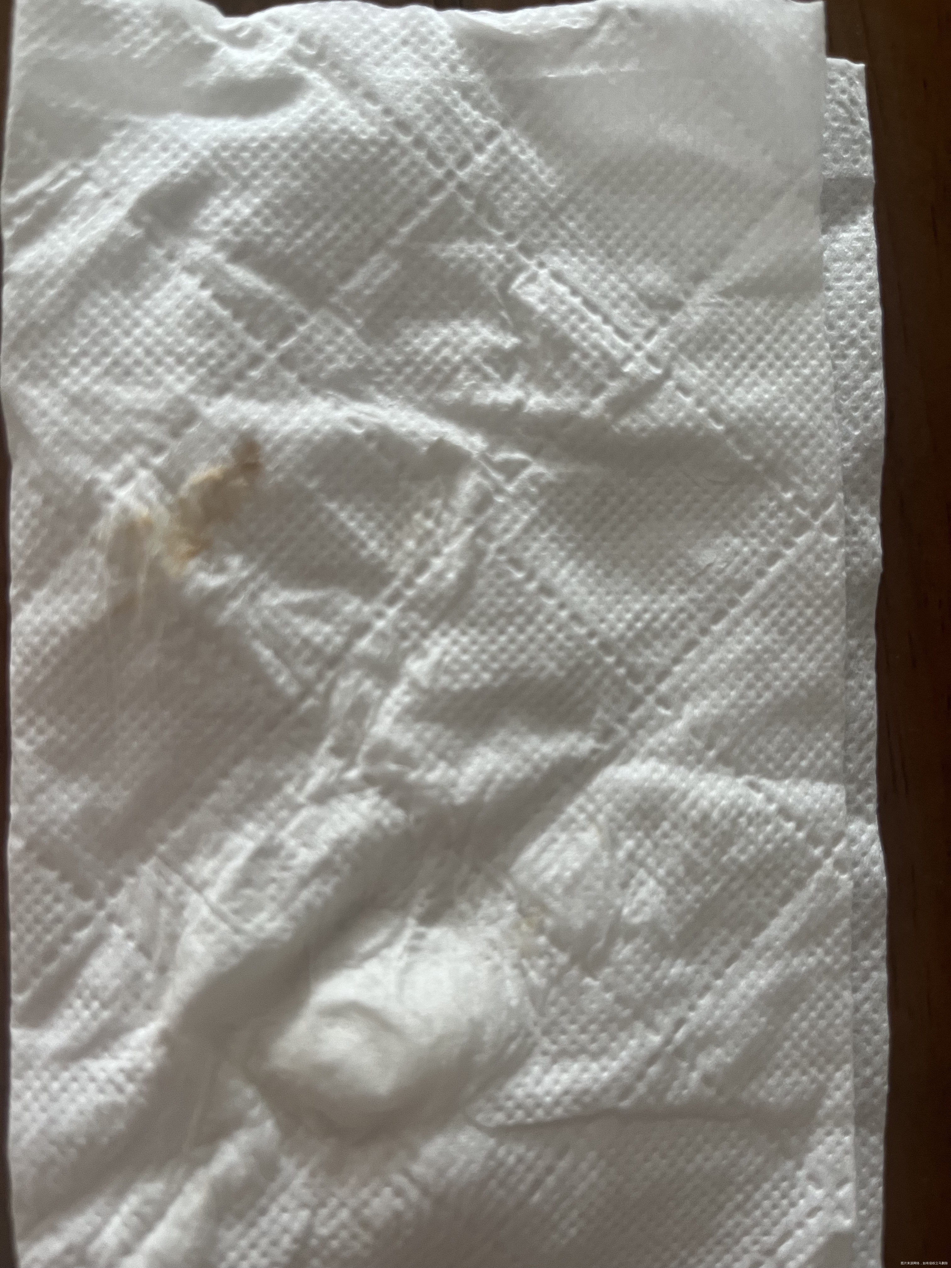 移植的第55天先后出现三次血样白带间隔是一个