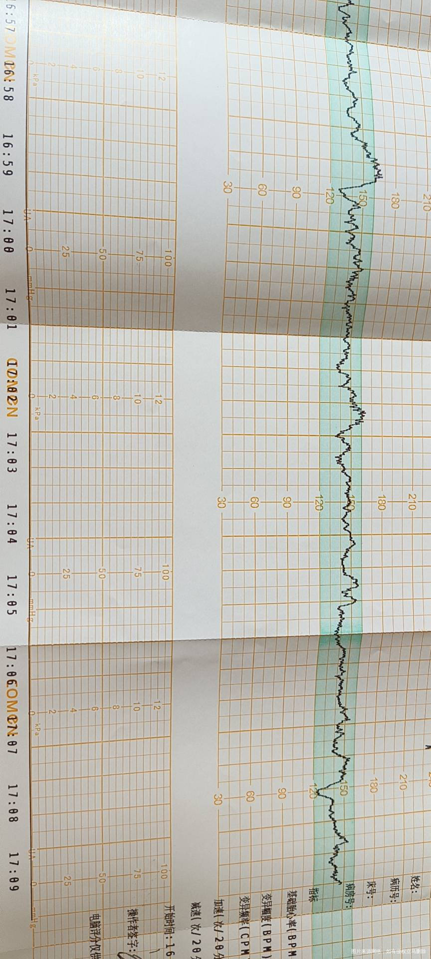 麻烦帮我看一下这个胎心监护