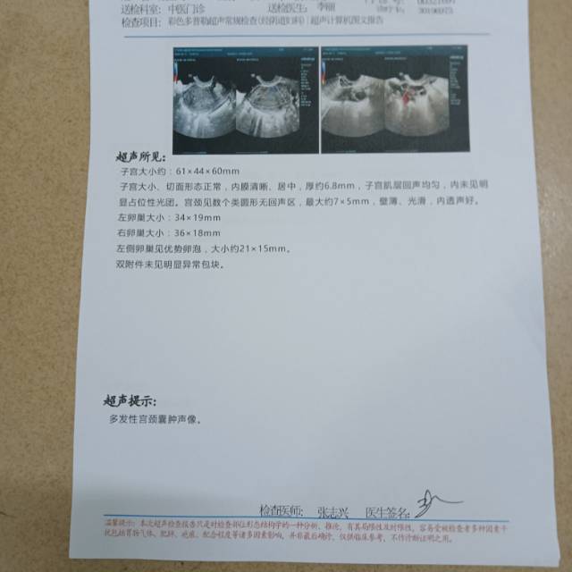 月经第十四天内膜薄可以受孕吗