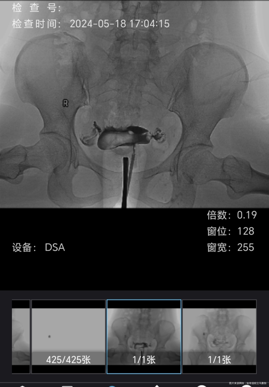 你好想问下这输卵管有问题吗