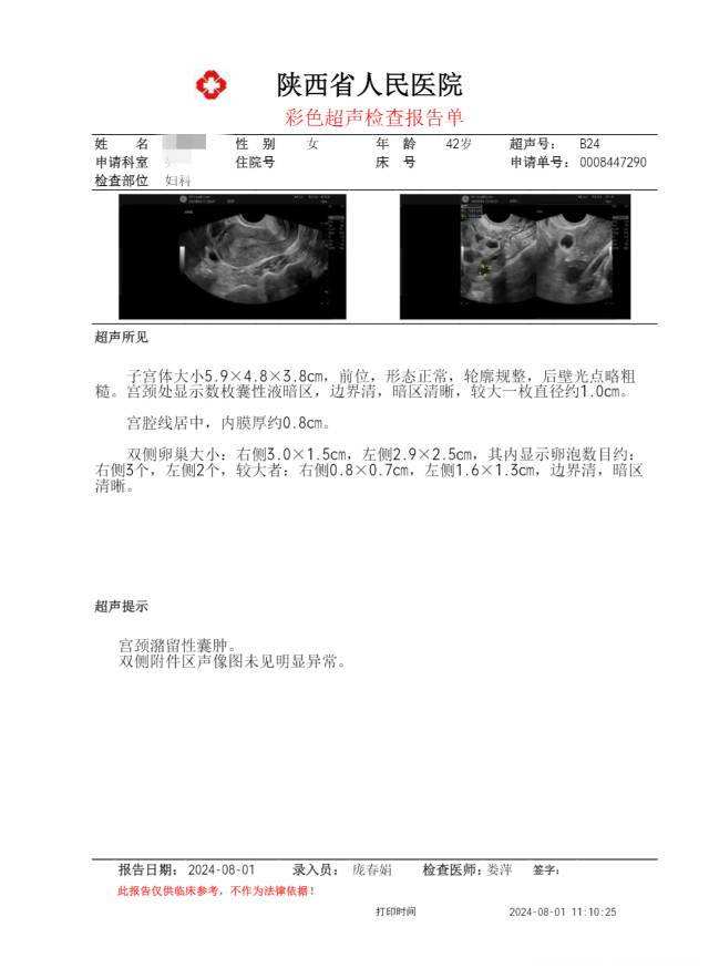 末次716724左侧卵泡15×11727当地