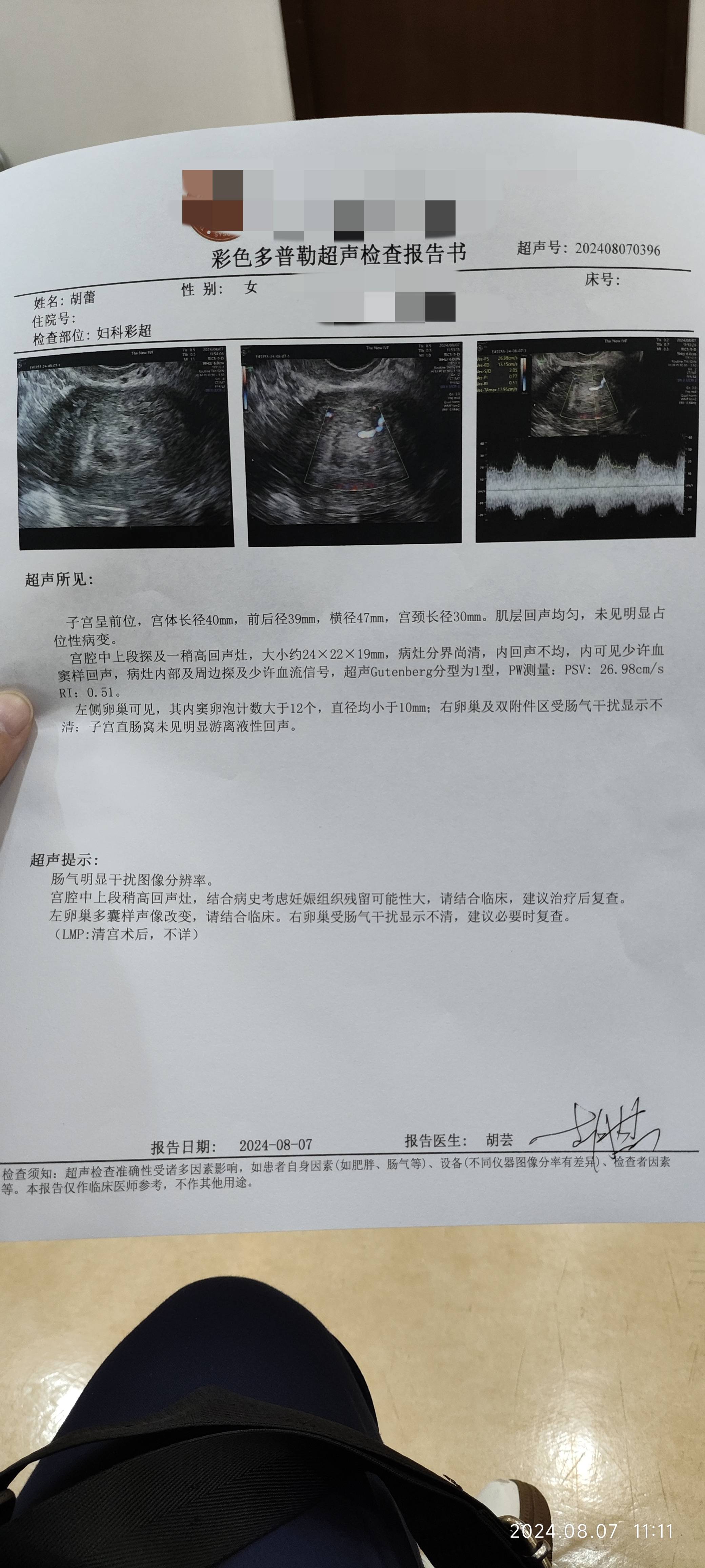 麻烦各位医生帮我看下这个人流术后的彩超单子超