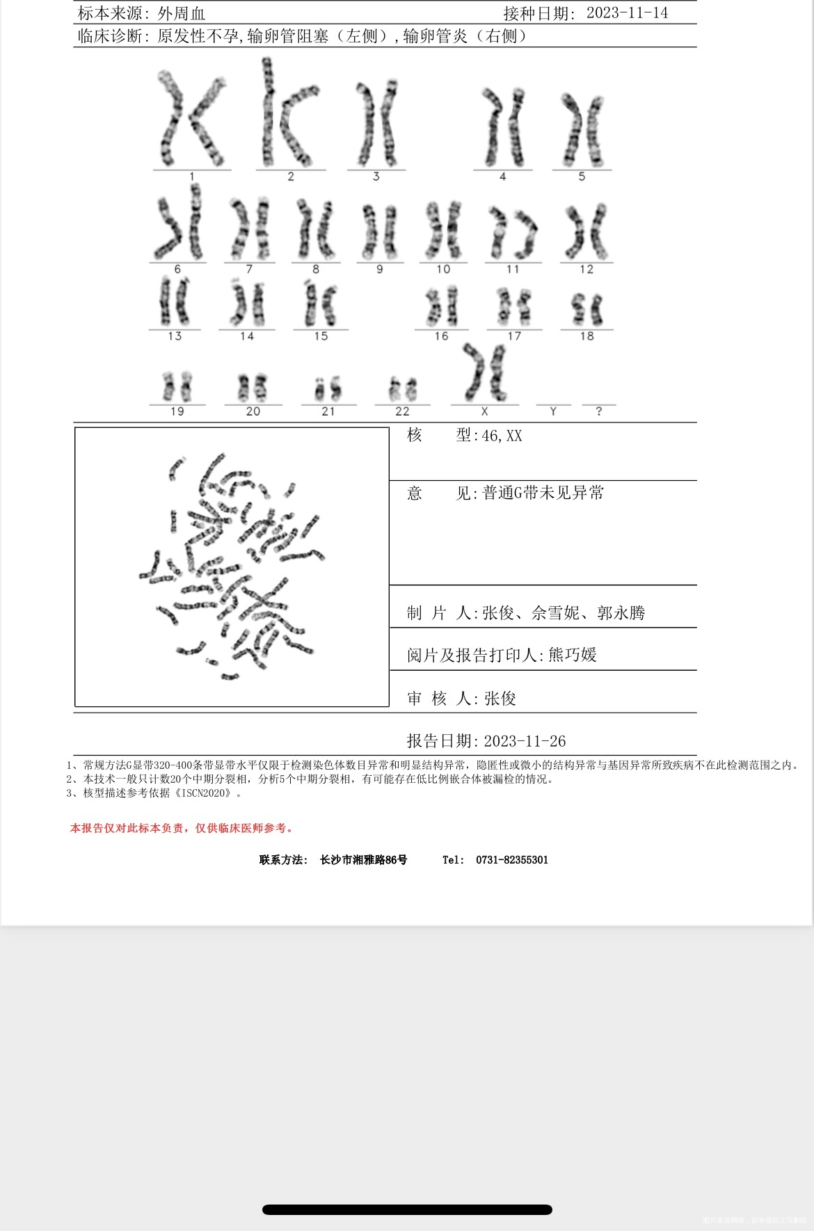 医生您好试管怀孕16周+孕前外周染色体正常无