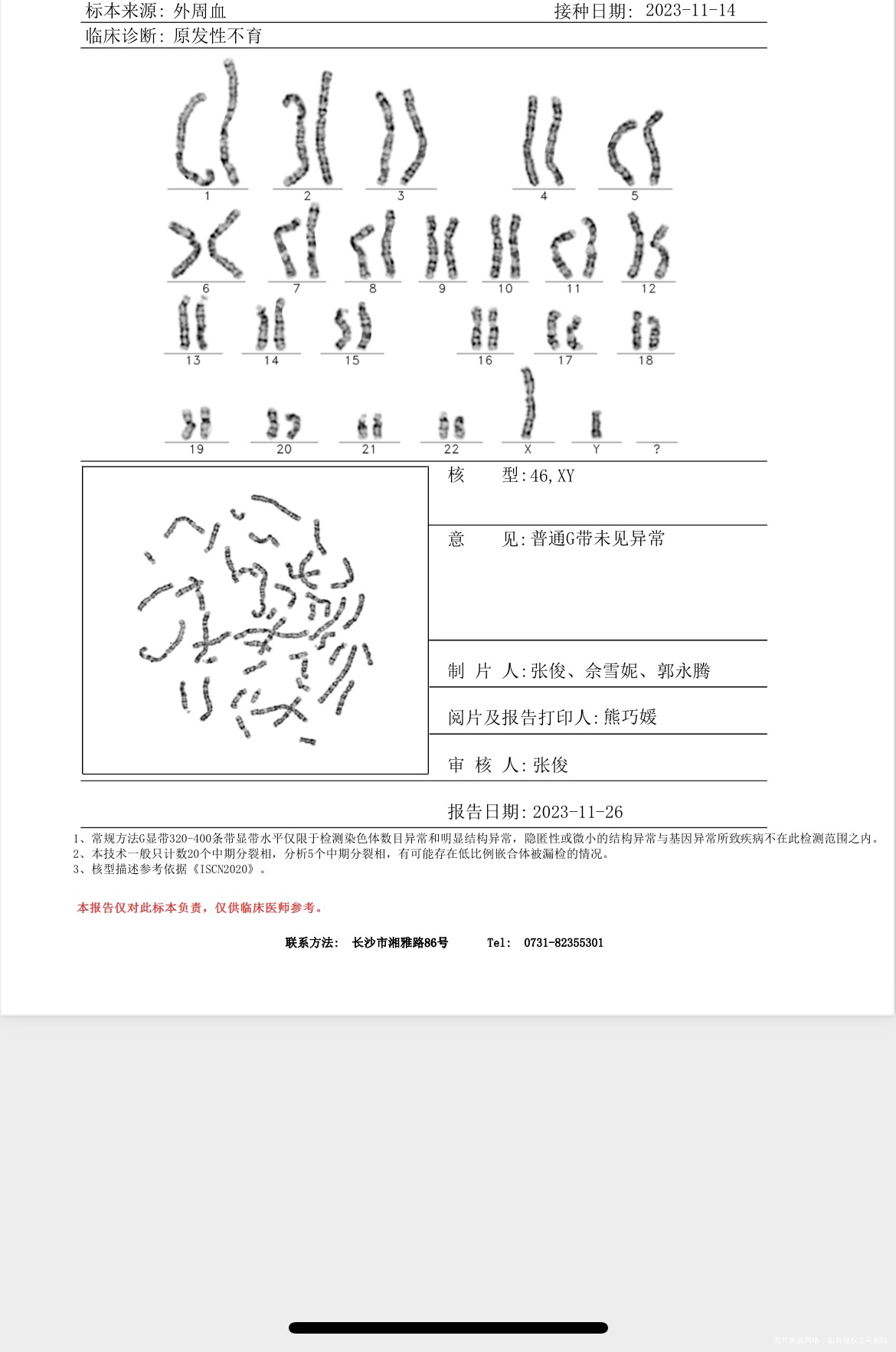 医生您好试管怀孕16周+孕前外周染色体正常无