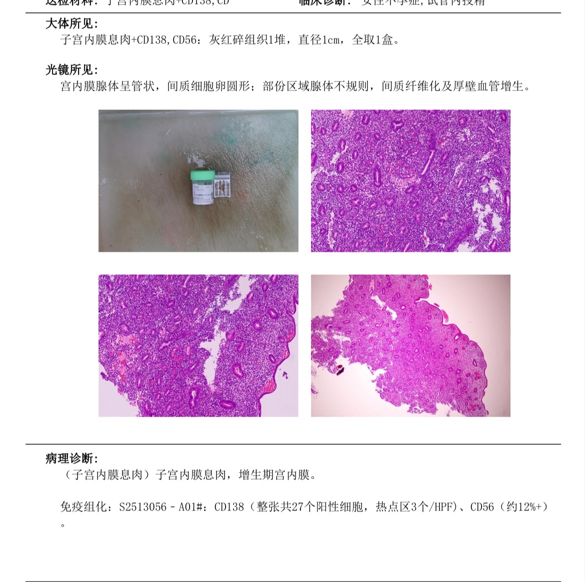 移植前做的宫腔镜检查报告出来看不懂麻烦帮忙看