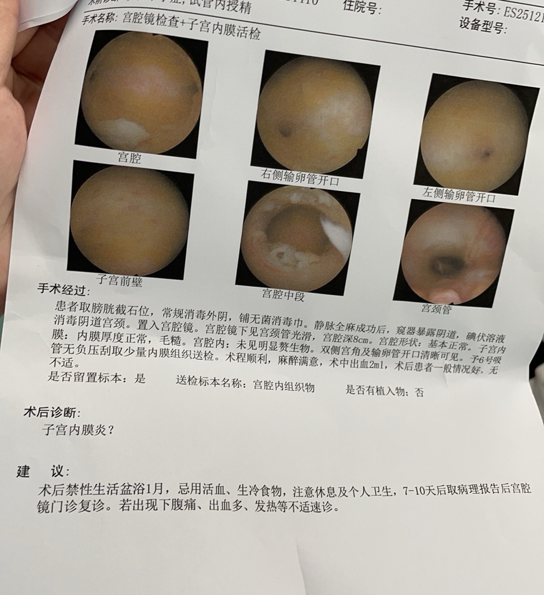 移植前做的宫腔镜检查报告出来看不懂麻烦帮忙看