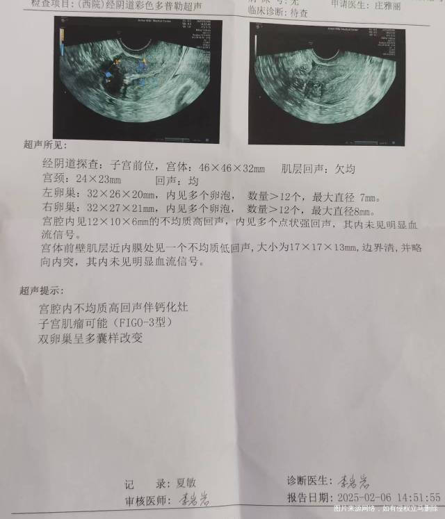 你好医生我35岁产后差不多2年了现在在备孕2