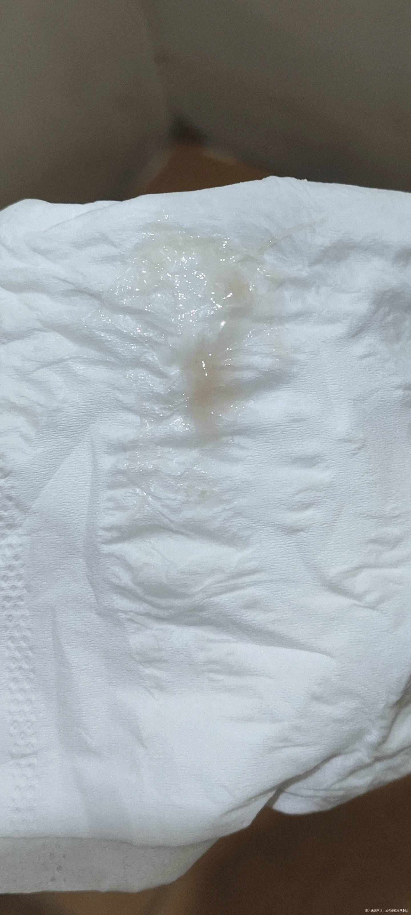 我是2025年1月25日移植的最近发现有这个