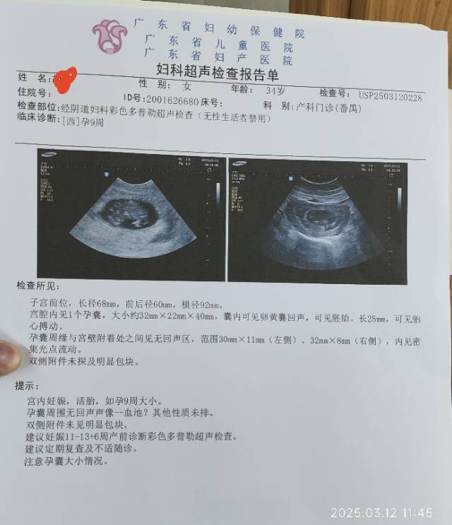 这个血池是什么意思有影响吗这个孕囊小不小第一
