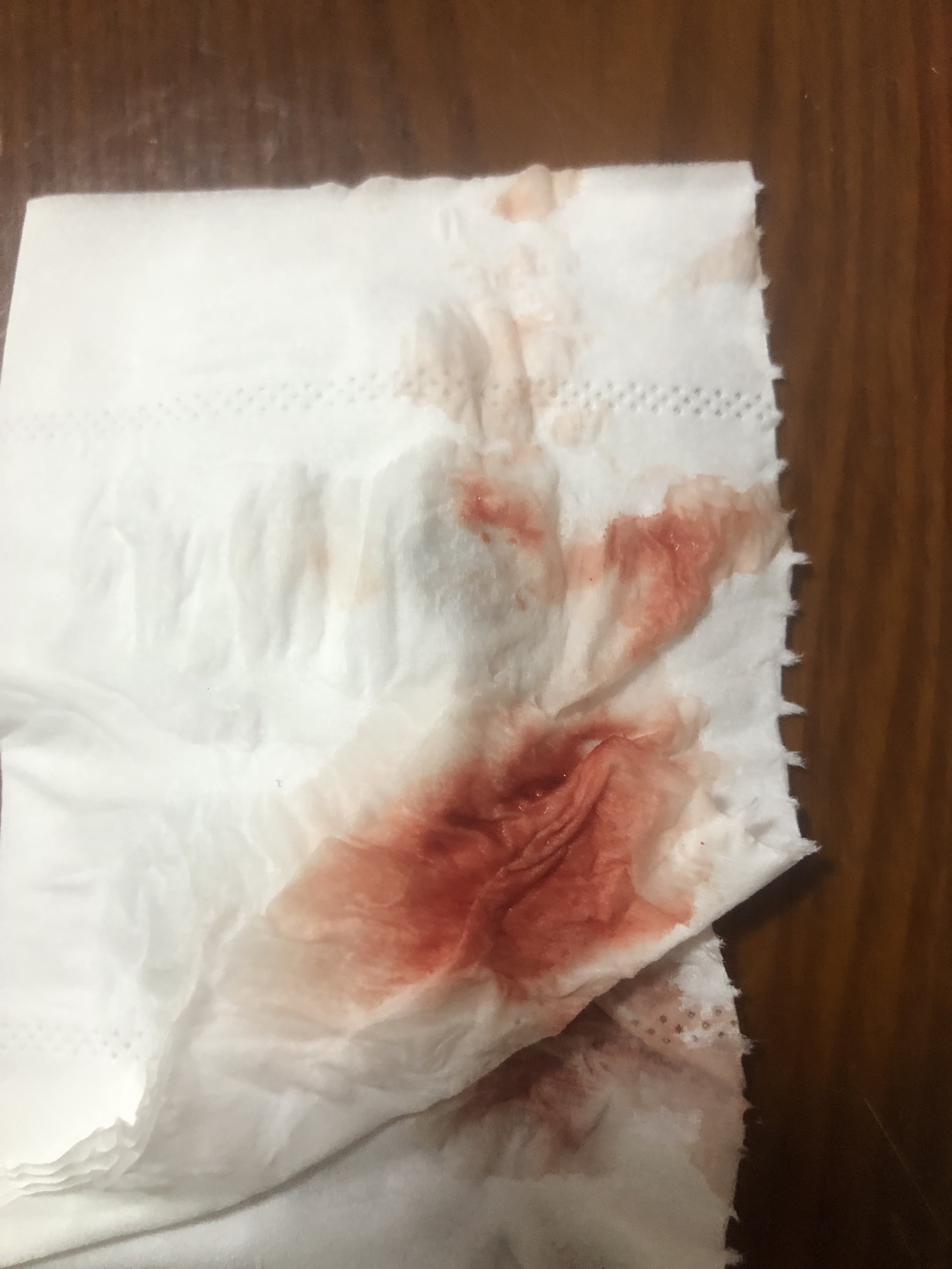 做的试管2月25日移植3月8医院抽血HCG1