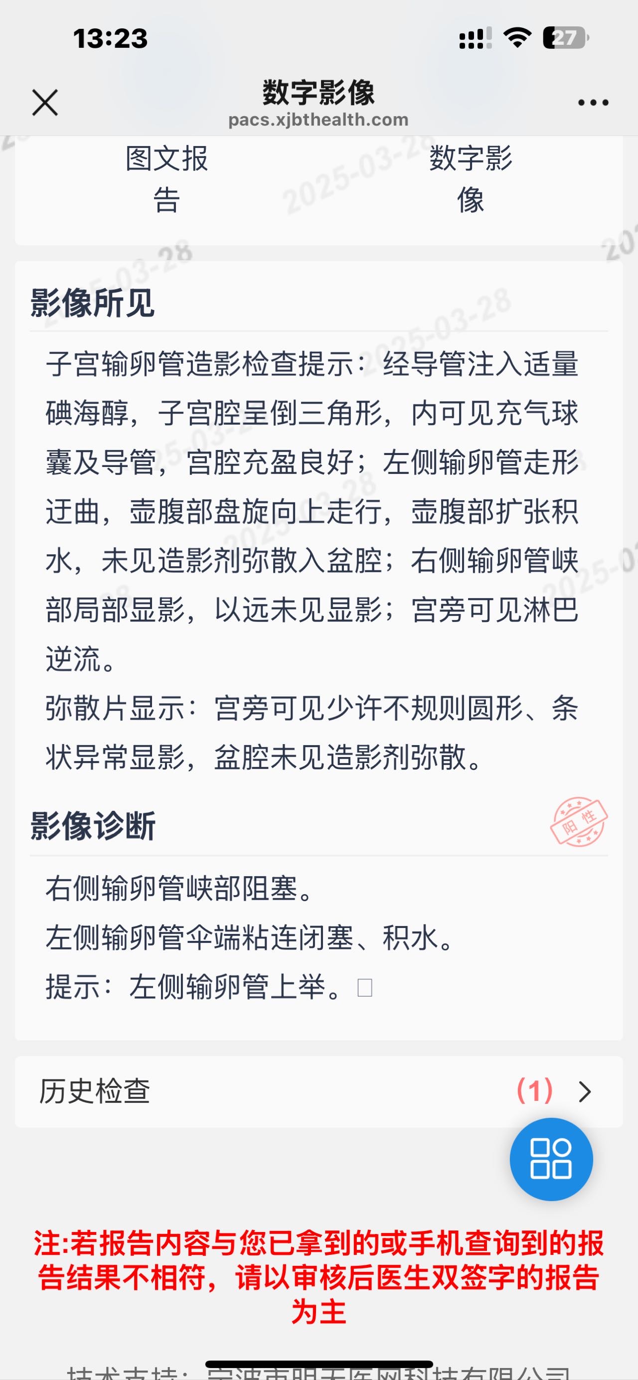 这种必须做手术么还是取了胚胎不是非要做