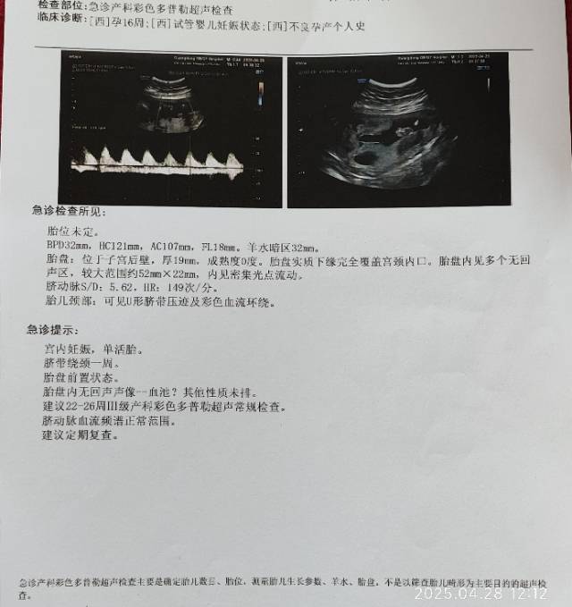 今天是怀孕16周去做了胎心监测还有做了一个B