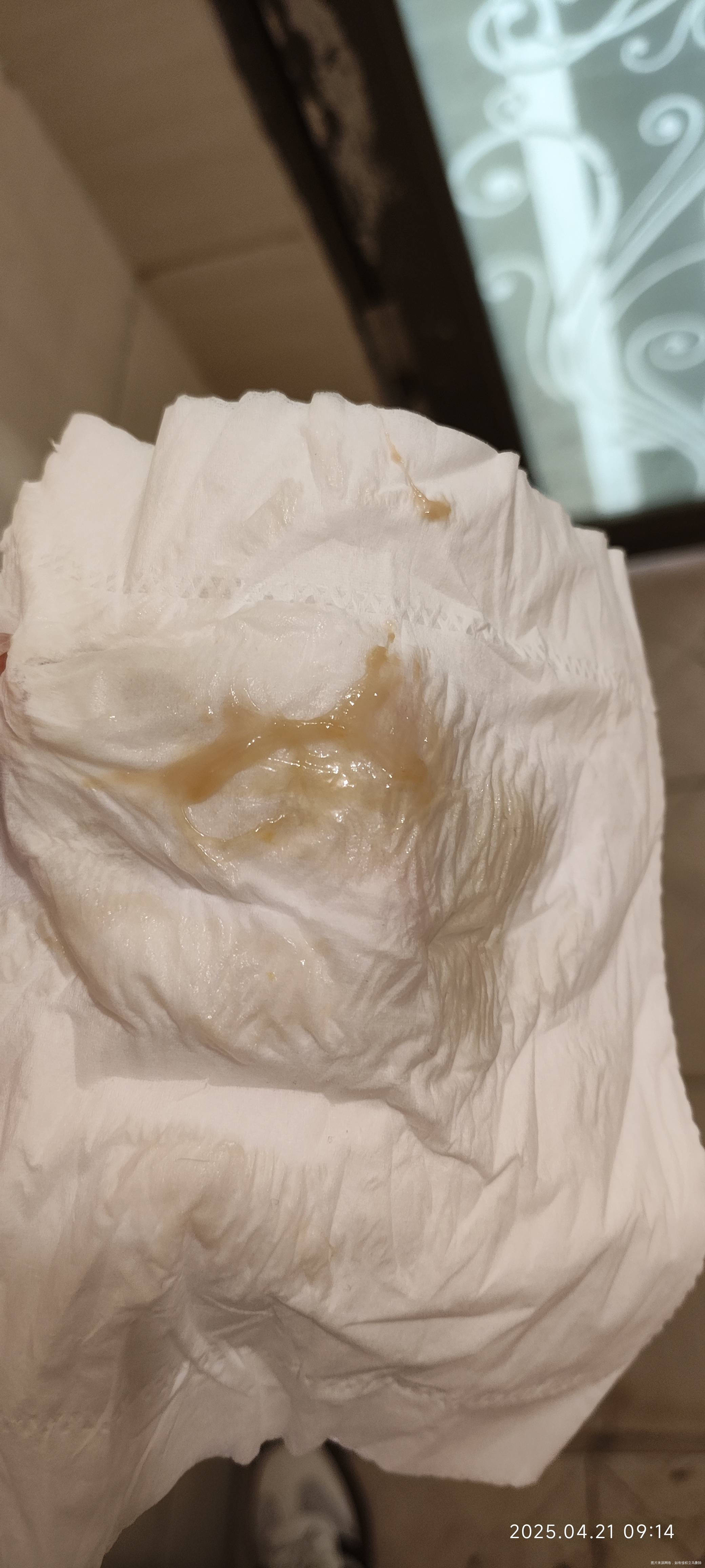 目前我是怀孕14周多这几天就这种深黄色分泌物