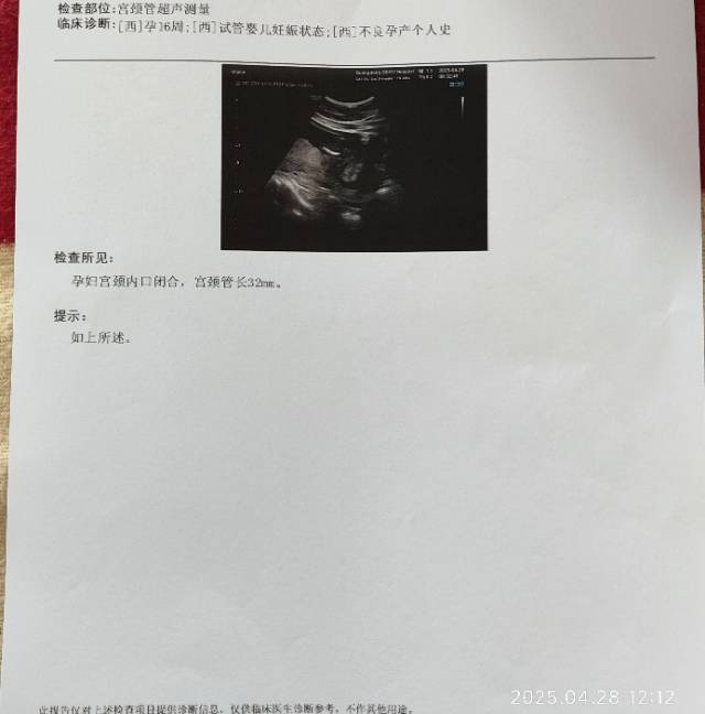 今天是怀孕16周去做了胎心监测还有做了一个B