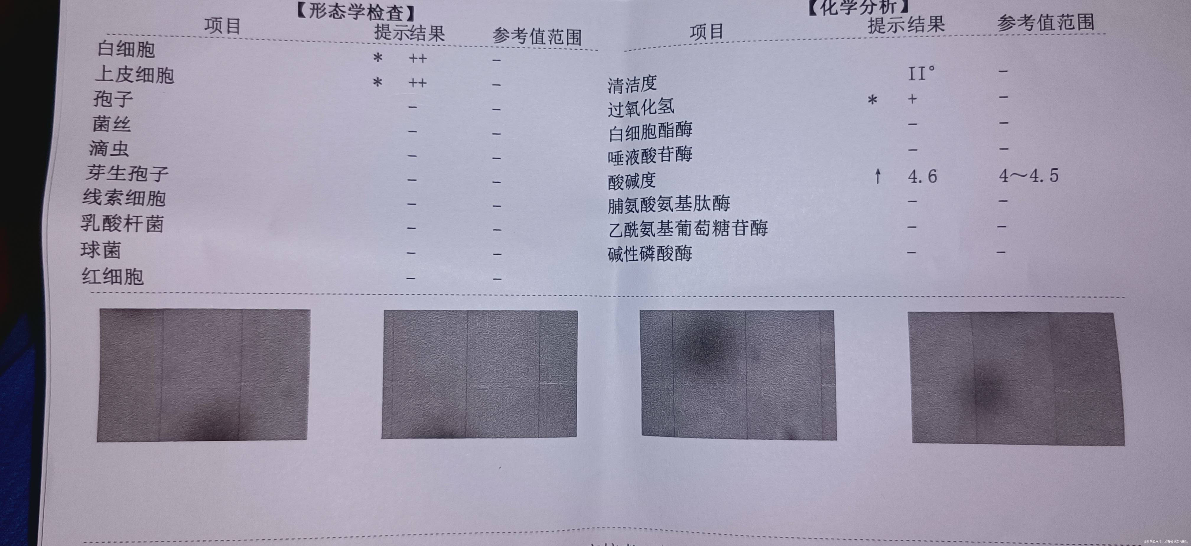 麻烦在线医生回复一下谢谢本人38岁备二胎一星