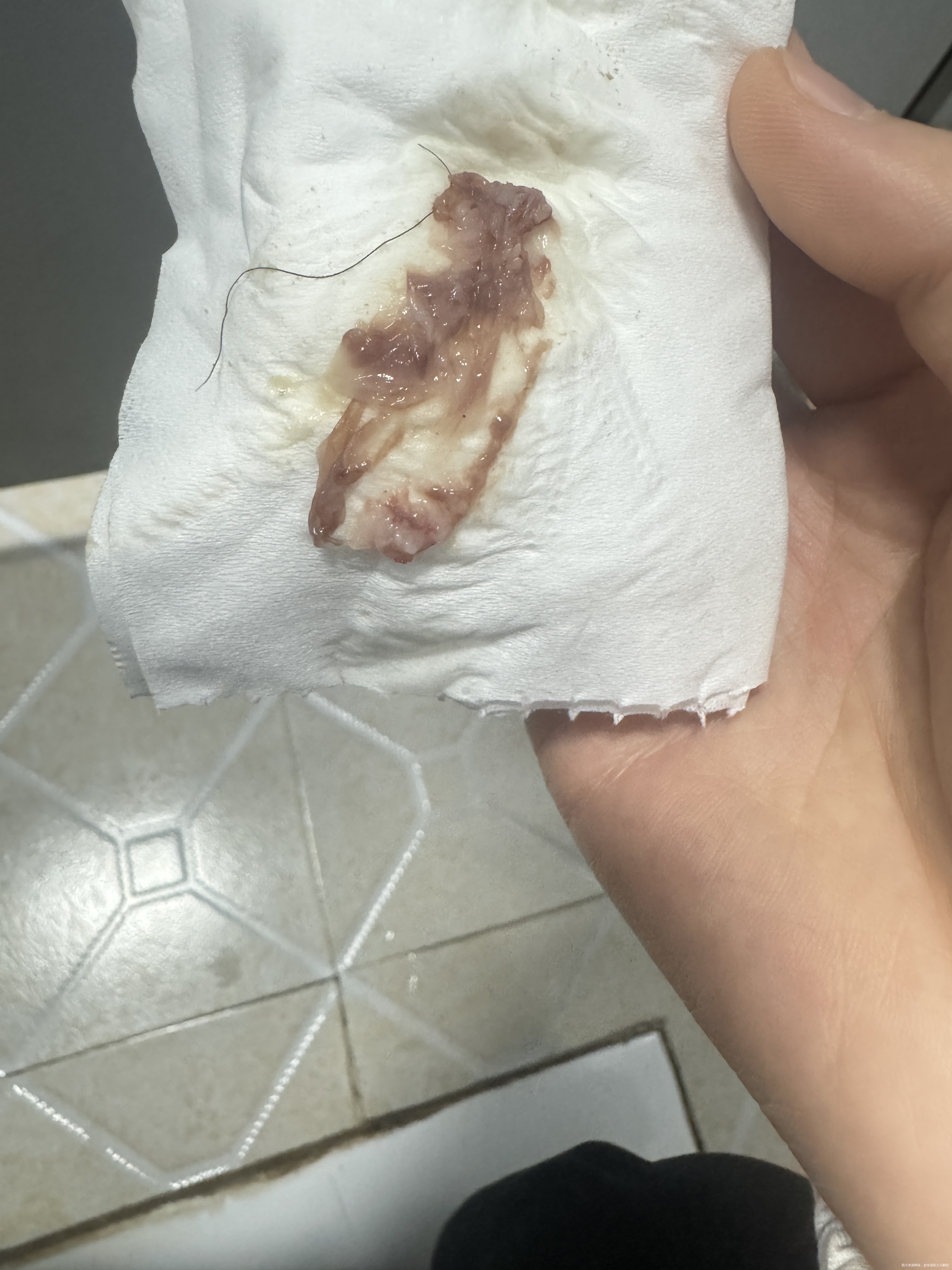 取卵3天后排出这种分泌物正常吗