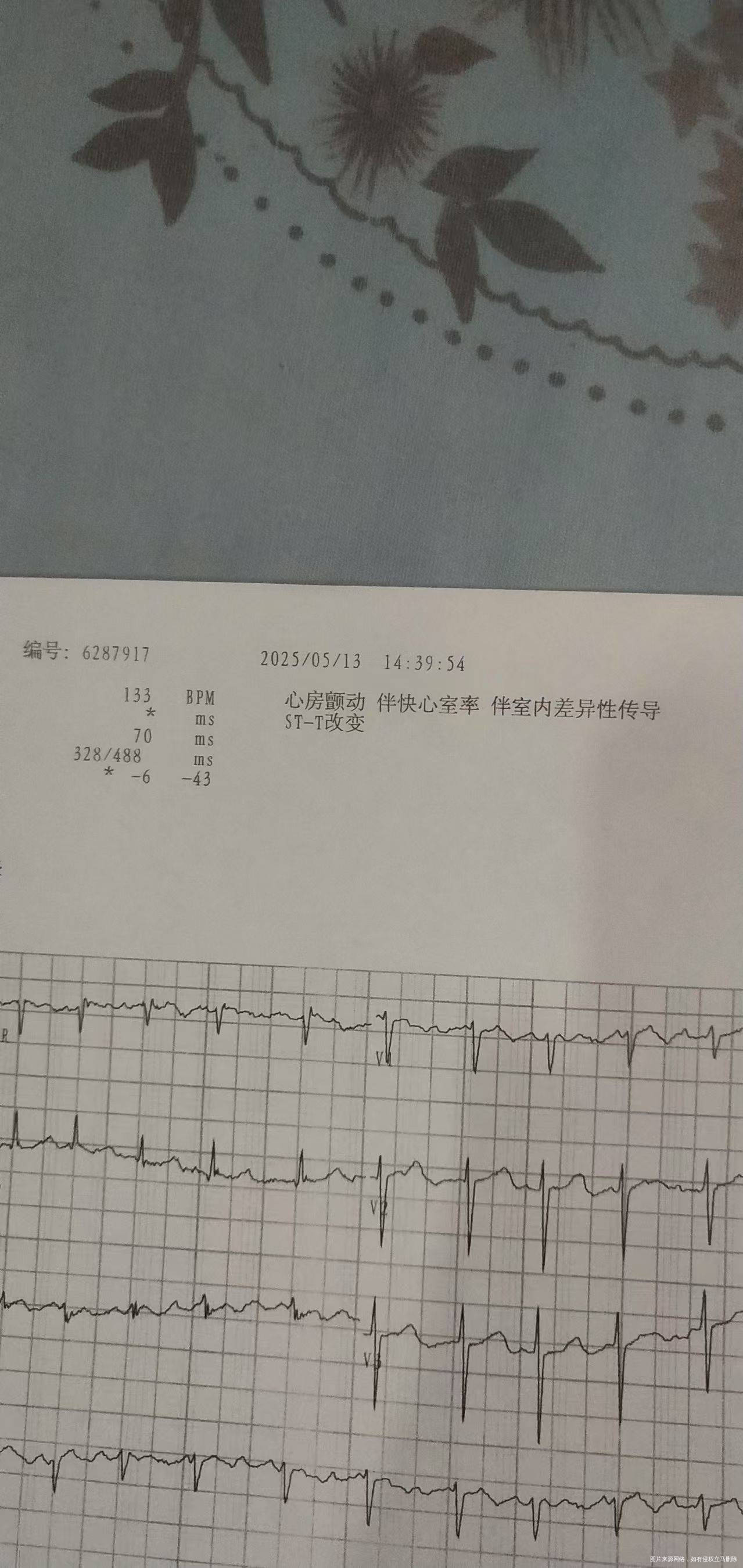 这是什么意思这种情况怎么办