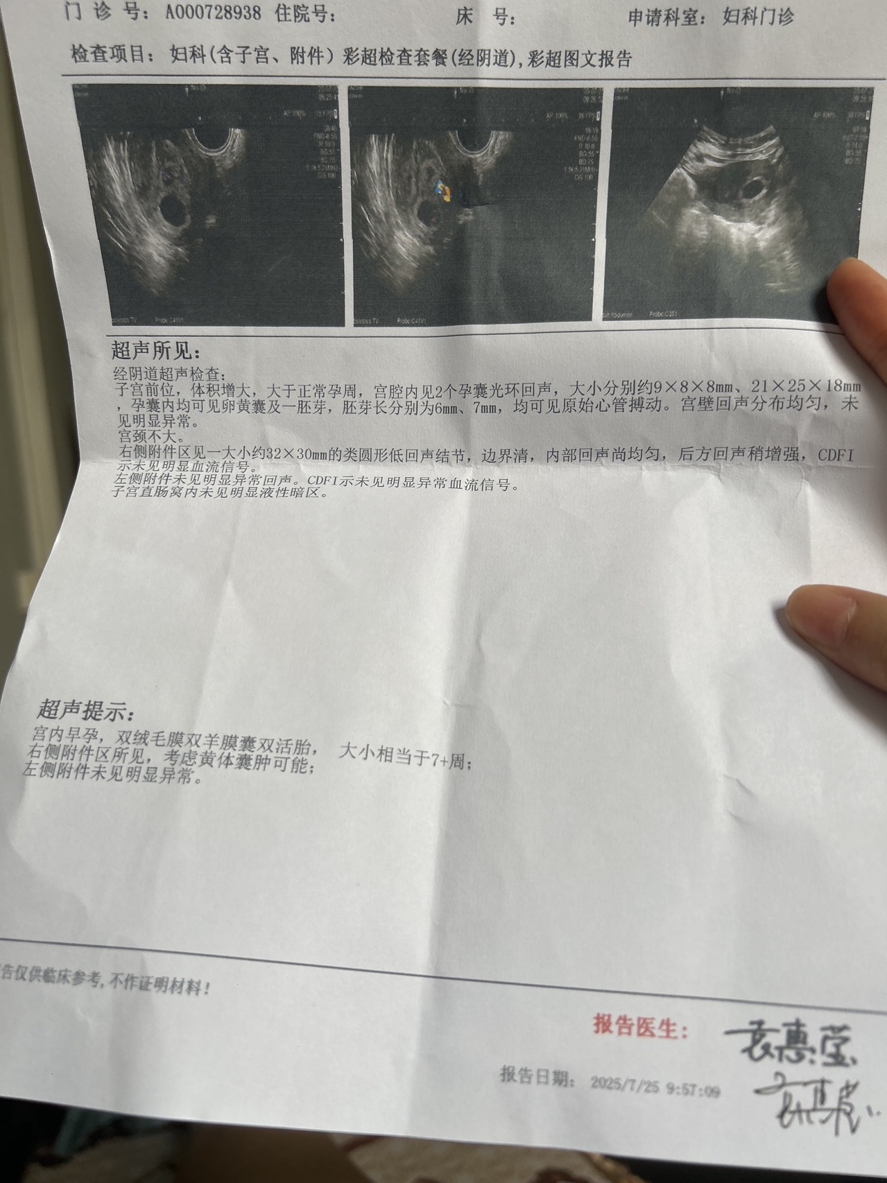 能看一下有什么问题吗