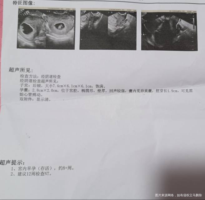 麻烦在线妇产科解答一下今天孕八周抽孕三项和b