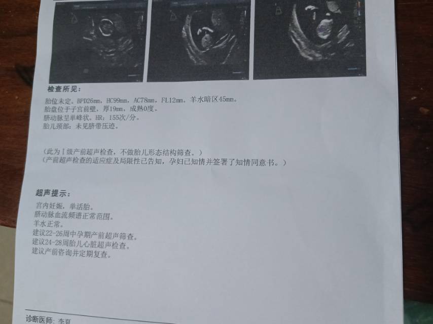 今天14周+3今天复查B超Hc头围99mm大