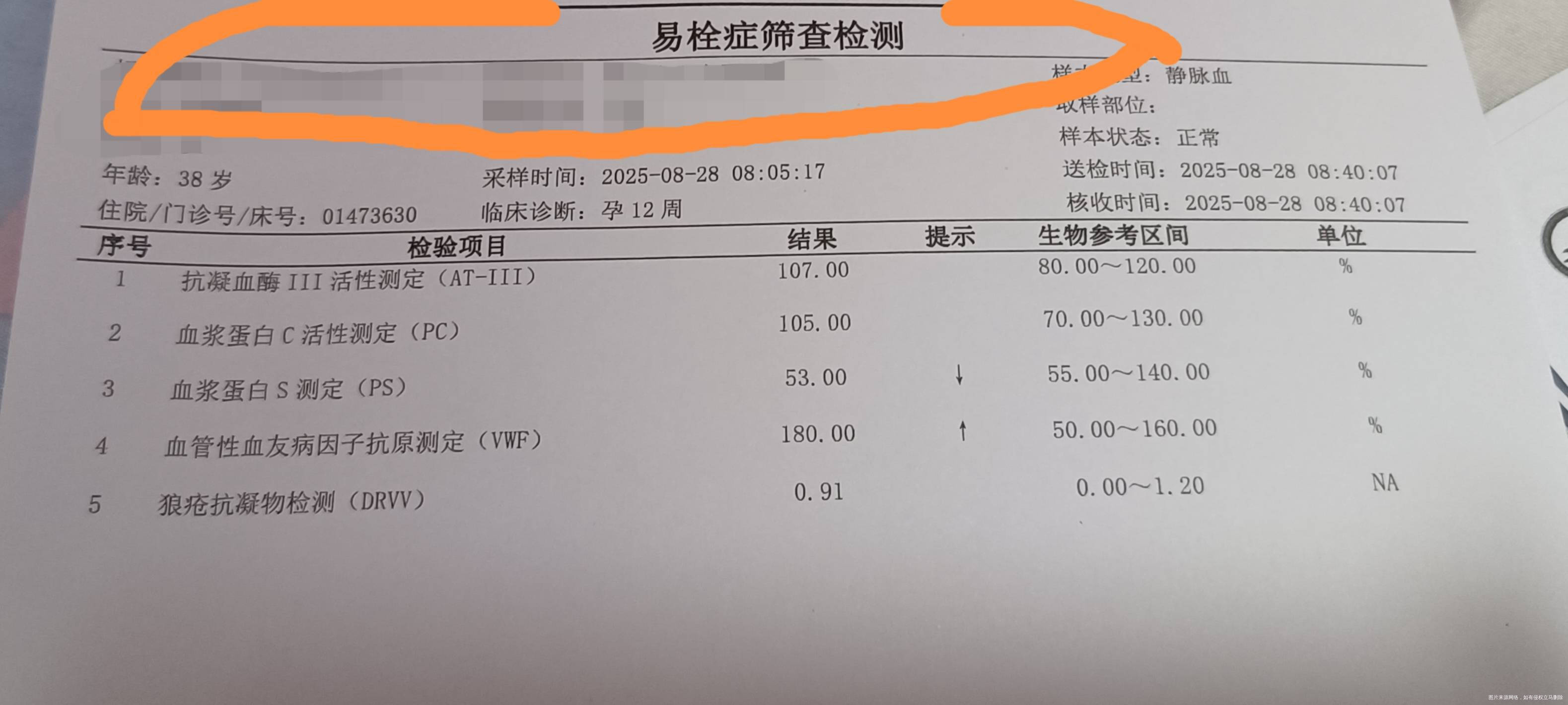 NT时发现宫腔积液40X5mm吃地屈孕酮片和