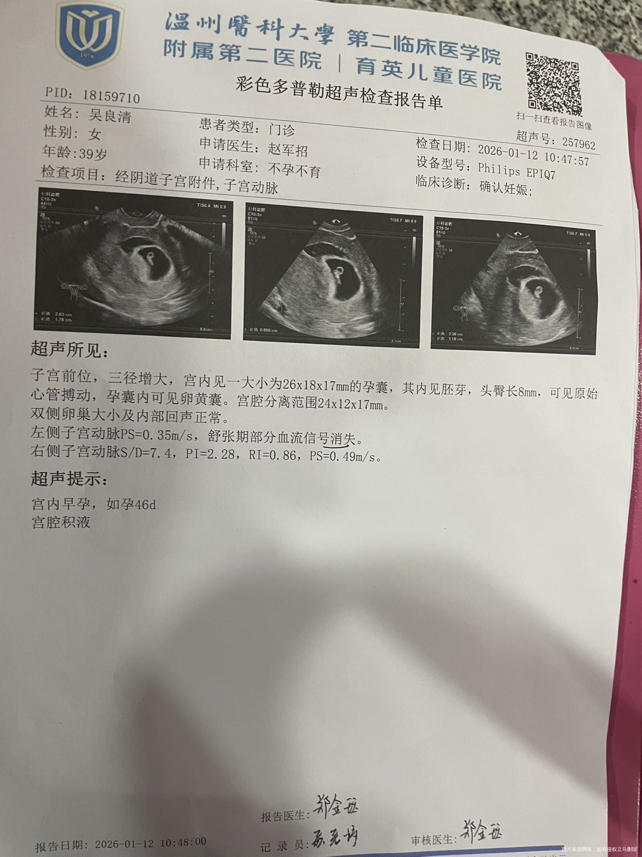 我这个报告可以吗需要注意什么