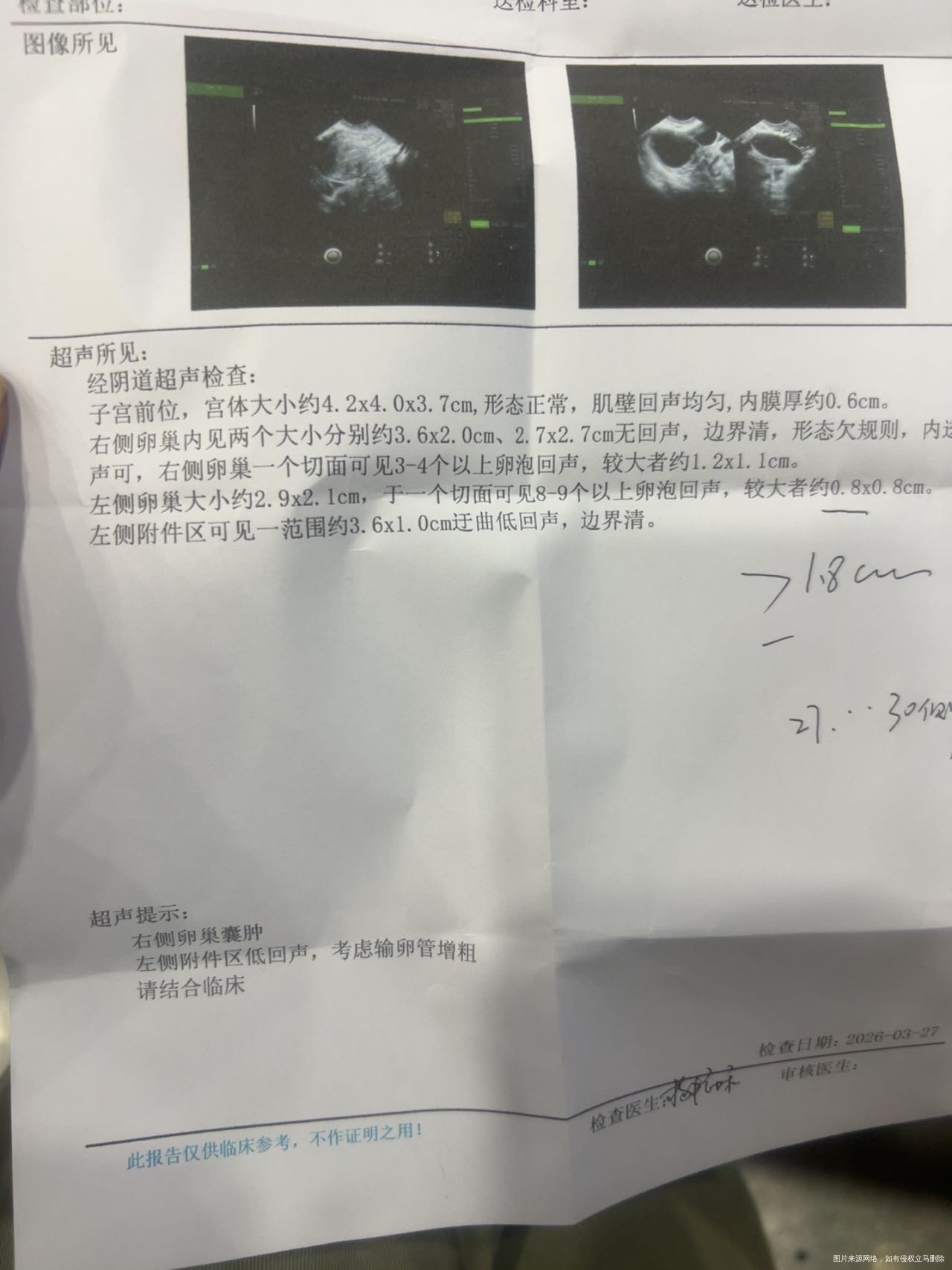 医生帮我看一下现在状态可以备孕了吗