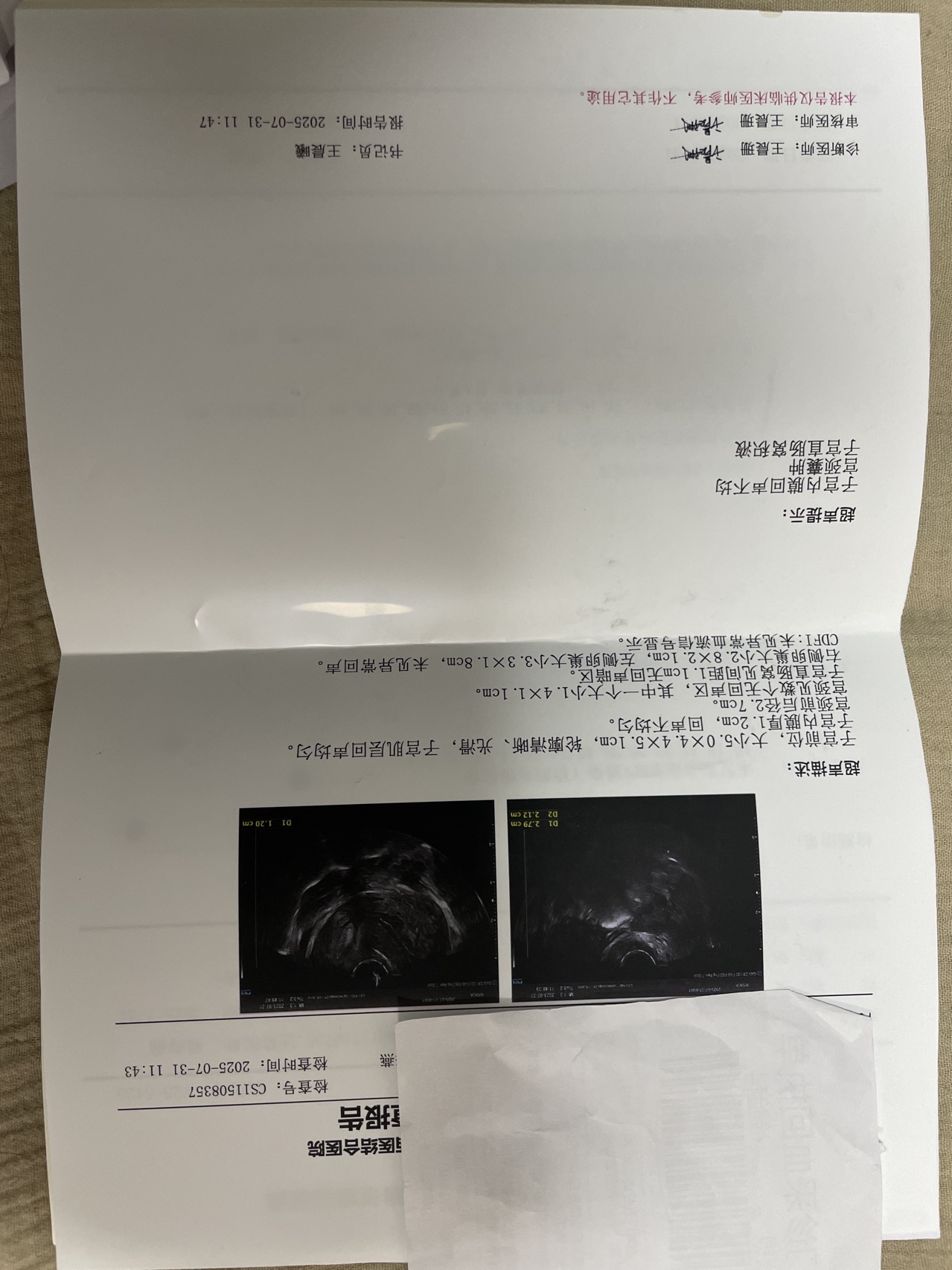 年纪37请问如何治疗谢谢