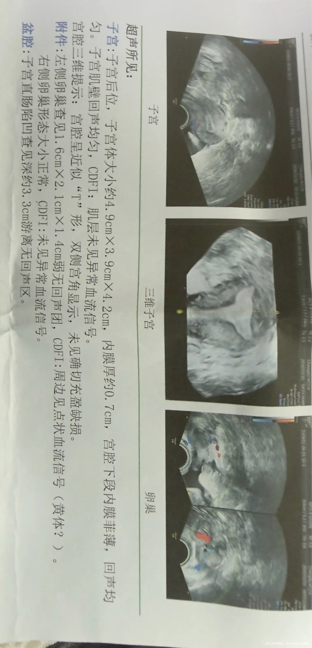 我这种情况做宫腔镜恢复的概率有多大