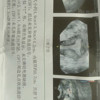 我这种情况做宫腔镜恢复的概率有多大