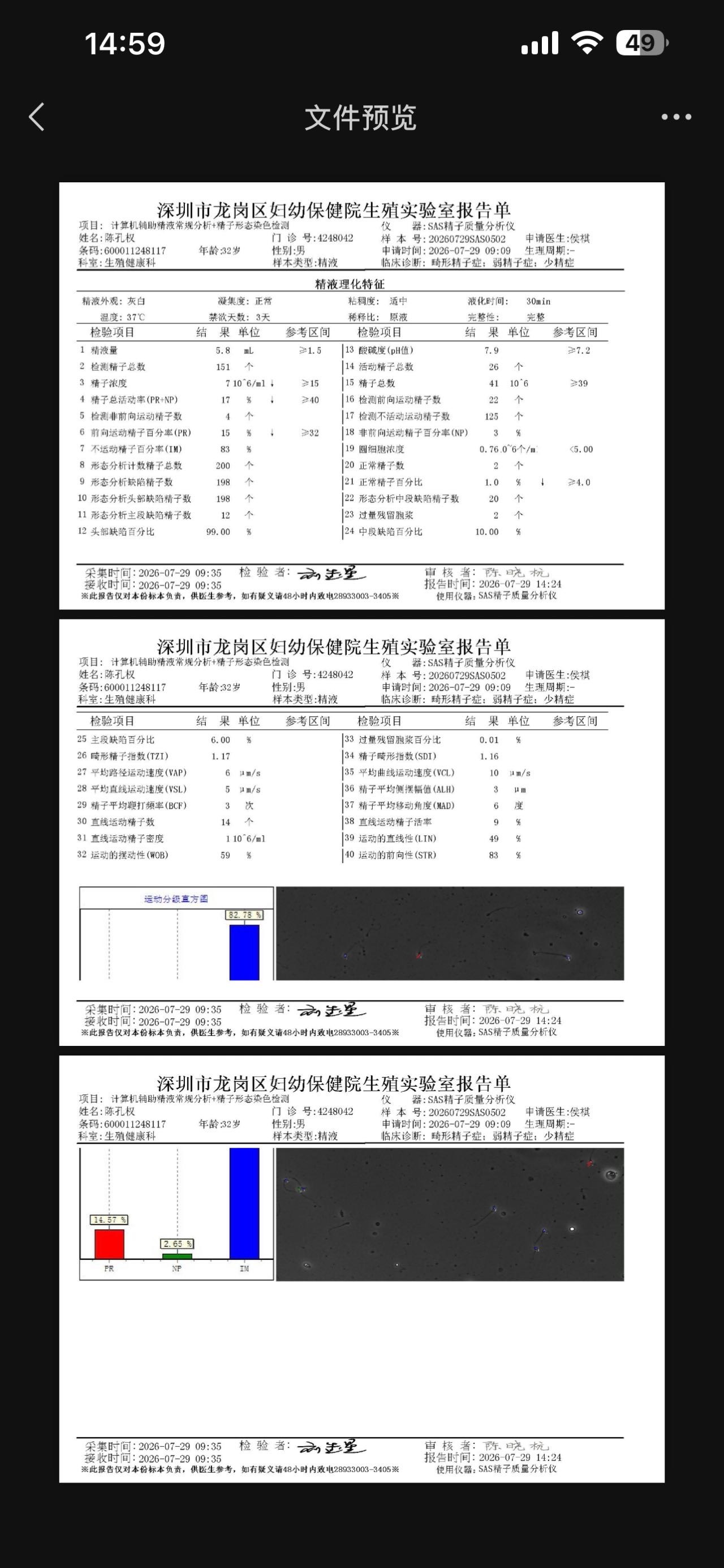 现在孕15周畸形精会不会对胎儿有影响