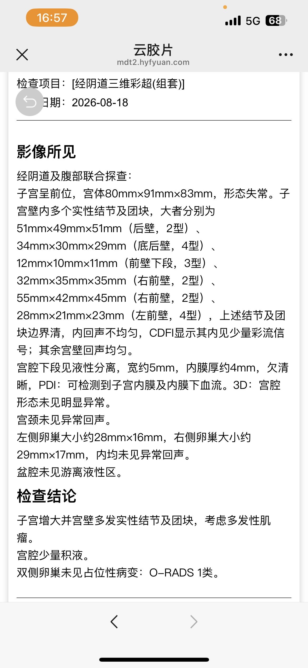 多发子宫肌瘤现在问了不同的医生有不同的方式1