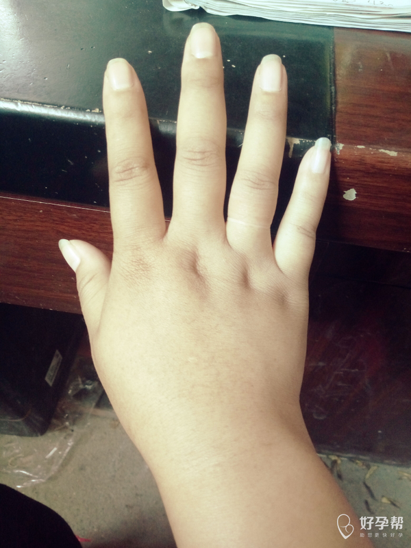 看这只胖手,,真是没谁了,.