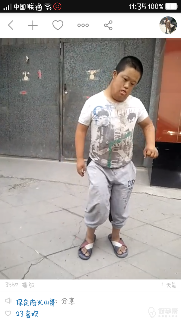 唐筛一定要做太可怕了