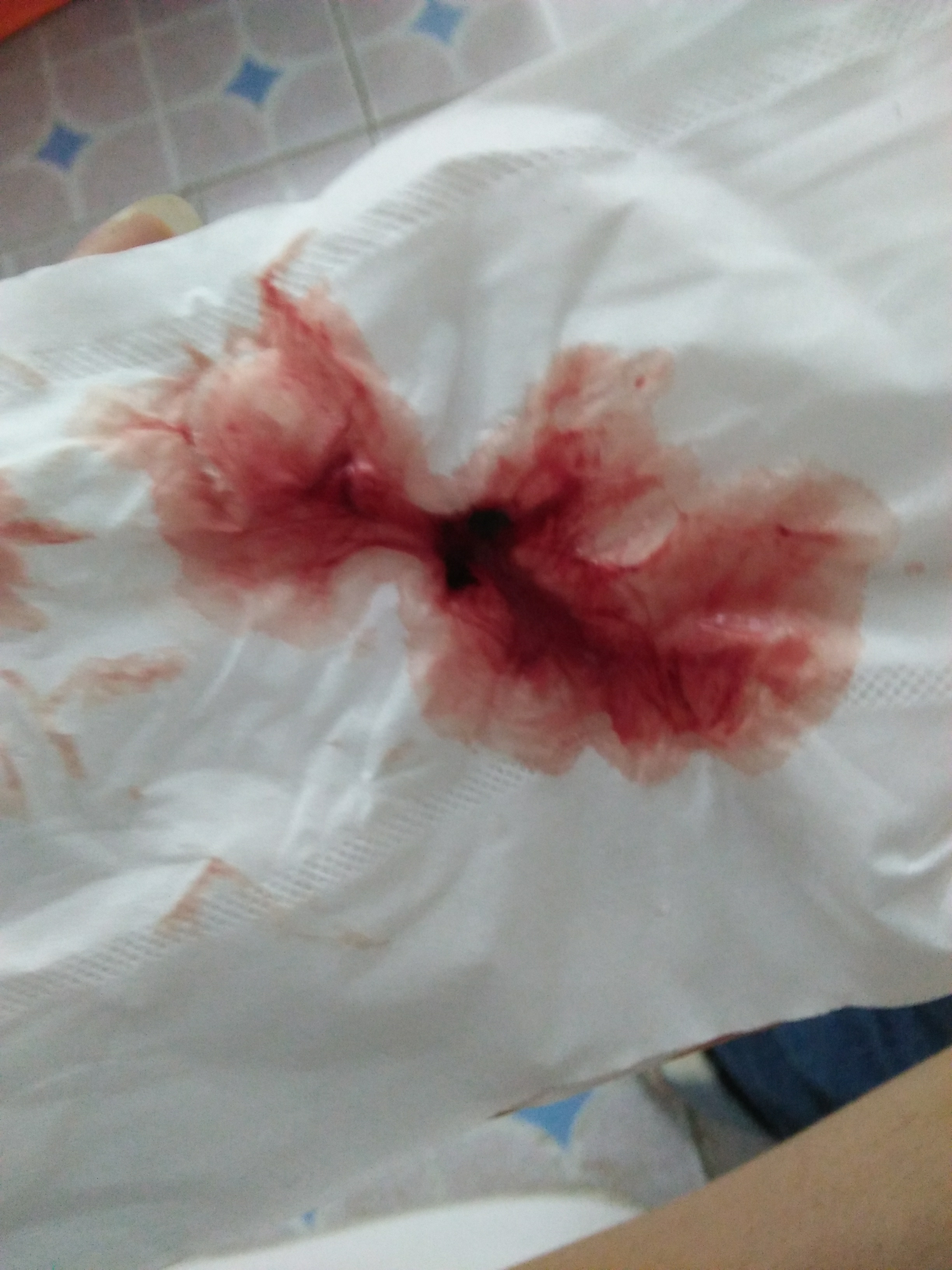 血纸巾真实照片吐血图片