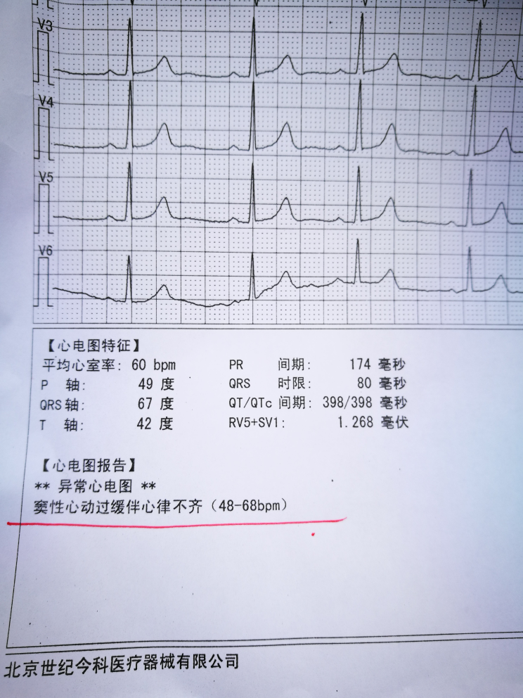 今天满12周产检做的心电图有点异常有知道的医生吗?这种情况严重吗?