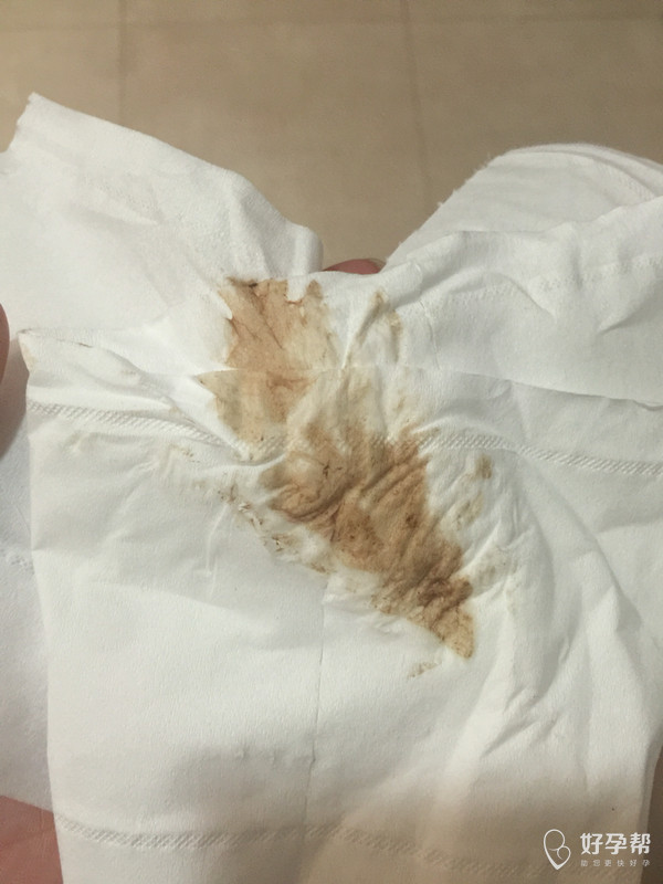 有没有怀孕7周加4的,有没有出现见红的状况,该怎么办呀?