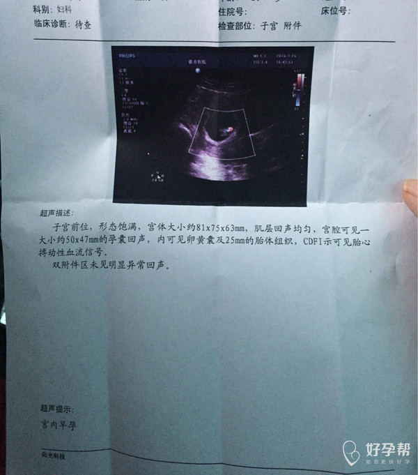 什么时候有胎心胎芽才是正常 gw-topic