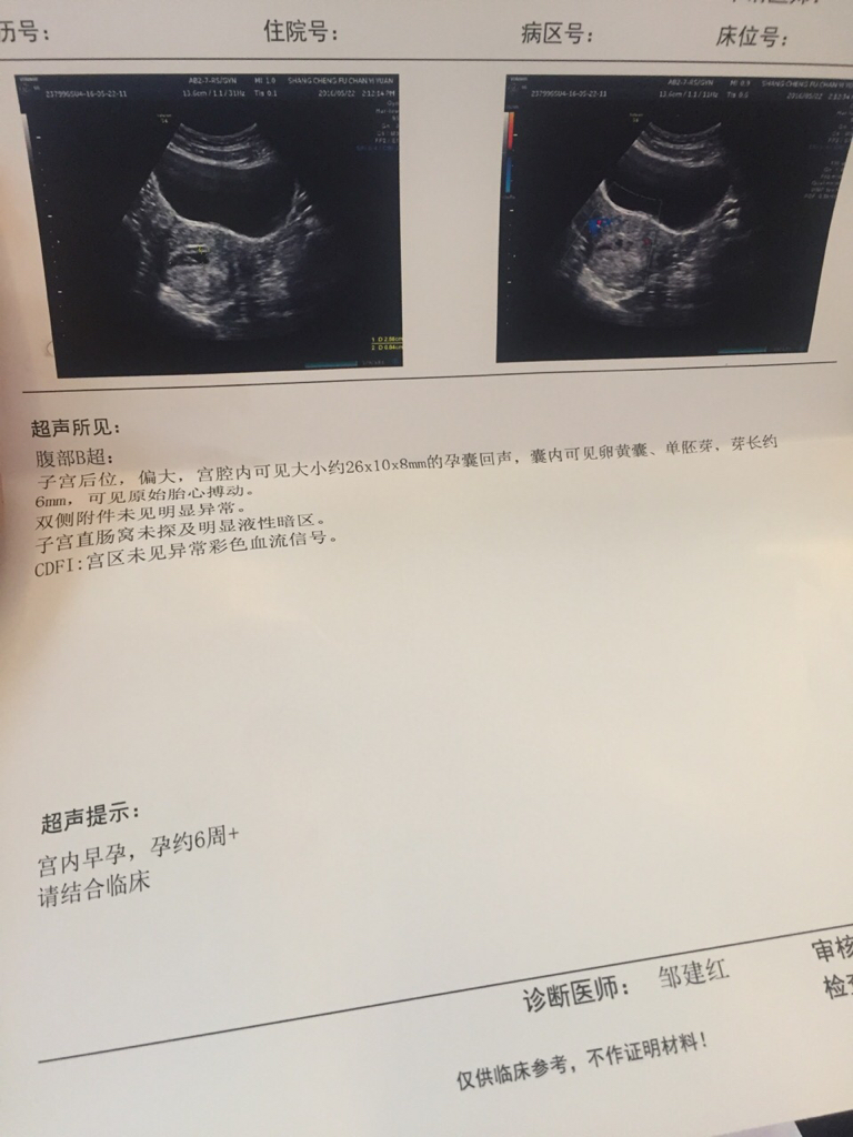 怀孕50天孕囊图片图片