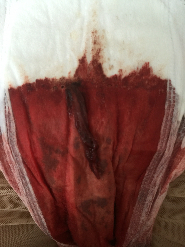 月经出血口是哪儿图片