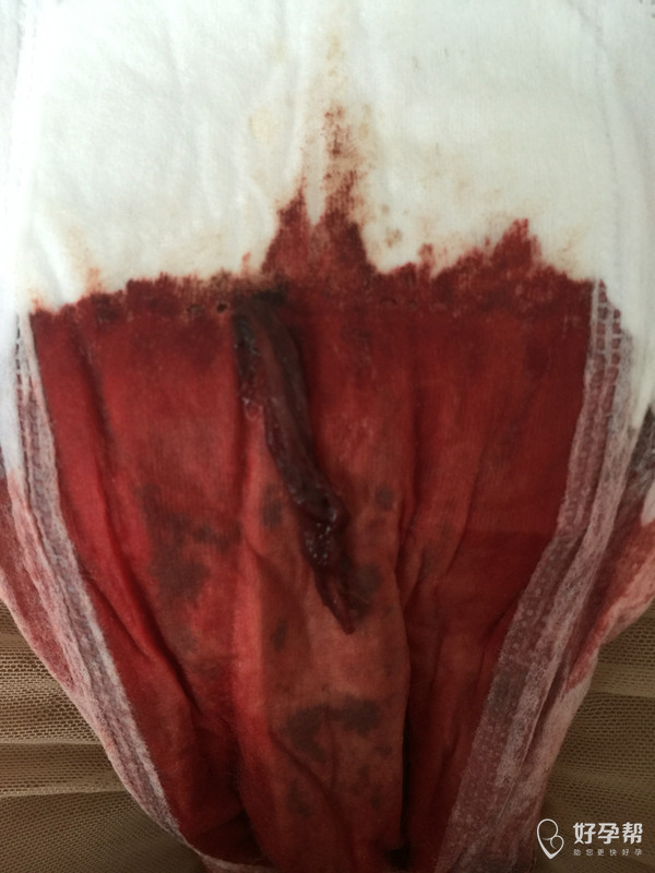 两个月没来例假现在来了不知道这是什么