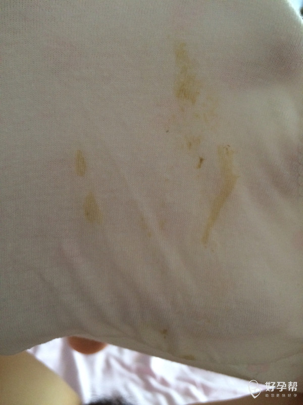 如题,之前见红了两次,打了三周保胎针后来一直内裤上这样,夹杂着白带