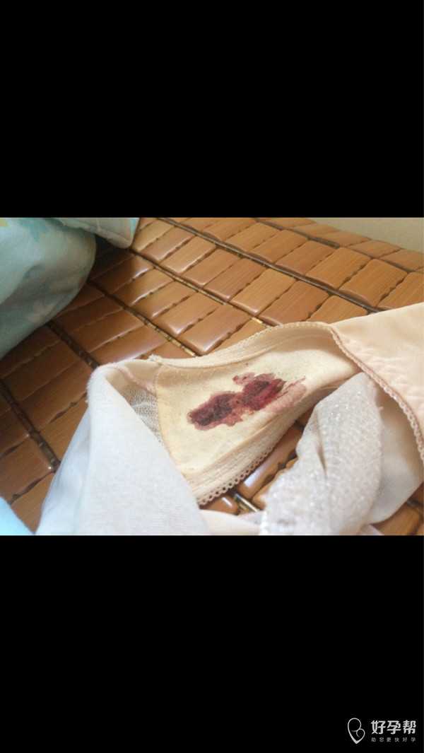 七月十三号来例假,八月十二号早孕试纸显示双杠.今天出血了,怎么办?