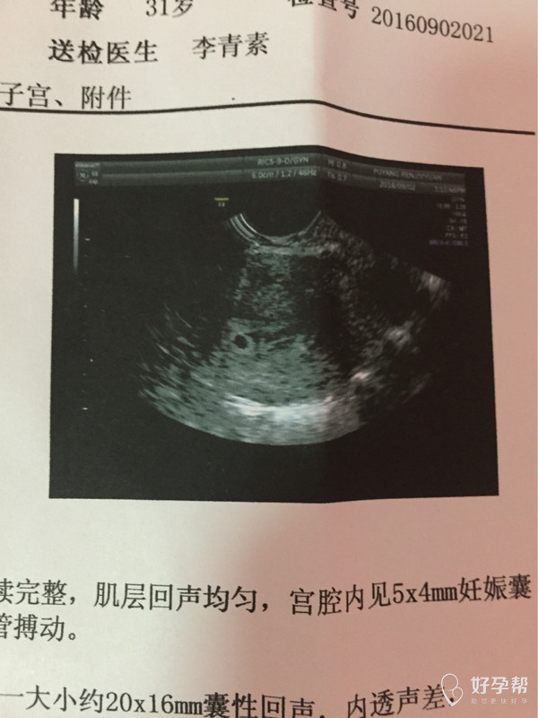 请问,孕囊5/4毫米,是女宝么?