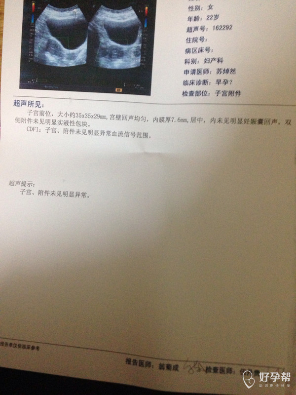 几个月可以查b超 gw-topic